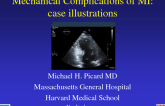 Mechanical Complications of MI: Case Ilustrations