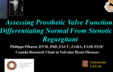  Assessing Prosthetic Valve Function: Differentiating Normal From Stenotic or Regurgitant