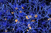 Midlife Vascular Risk Factors Linked to Amyloid Plaques in Alzheimer’s