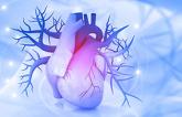 Score May Ease Risk Stratification in Acute MI-Related Cardiogenic Shock