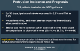 Carotid Artery Stenting: Investigation of Plaque Protrusion Incidence and Prognosis