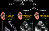 Low Gradient, Severe Aortic Stenosis