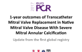1-year Outcomes of Transcatheter Mitral Valve Replacement in Native Mitral Valve Disease With Severe Mitral Annular Calcification