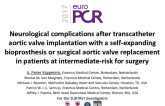 Neurological Complications After Transcatheter Aortic Valve Implantation with a Self-Expanding Bioprosthesis or Surgical Aortic Valve Replacement in Patients at Intermediate-Risk for Surgery