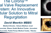 The Corona Mitral Valve Replacement System: An Innovative Modular Solution to Mitral Regurgitation