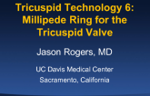Tricuspid Technology 6: Millipede