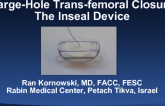 Large-Hole Trans-femoral Closure II: The InSeal Device