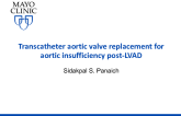 Transcatheter Aortic Valve Replacement for Aortic Insufficiency Post-left Ventricular Assist Device
