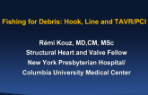 Fishing for Debris: Hook, Line, and TAVR/PCI