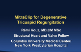 MitraClip for Degenerative Tricuspid Regurgitation