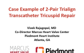 Transcatheter Tricuspid Repair of Patient With Severe TR and Mitral Stenois