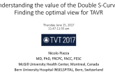 Understanding the Value of the FluoroCT “Double S Curve”: Finding the Optimal View for TAVR
