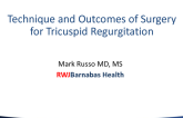 Technique and Outcomes of Surgery for Tricuspid Regurgitation