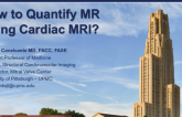 How to Quantify MR Using Cardiac MRI