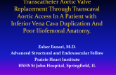 Transcatheter Aortic Valve Replacement Through Transcaval Aortic Access in a Patient With Inferior Vena Cava Duplication And Poor Iliofemoral Anatomy