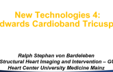 Tricuspid Technology 4: Cardioband