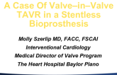 Case Presentation: A Case of Valve-in-Valve TAVR in a Stentless Bioprosthesis