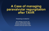 Case Tutorial #2: A Case of Managing Para-valvular Regurgitation During TAVR - Case Presentation