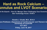 Hard as Rock Calcium – Annulus and LOVT Scenarios