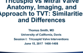 Tricuspid vs Mitral Valve Anatomy, Imaging, and Approach to TVT: Similarities and Differences