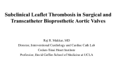 Subclinical Leaflet Thrombosis in Surgical and Transcatheter Bioprosthetic Aortic Valves – Cautionary Findings and Clinical Implications