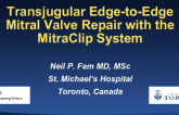 Transjugular Edge-to-Edge Mitral Valve Repair With the MitraClip System