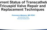 Current Status of Transcatheter Tricuspid Valve Repair and Replacement Techniques