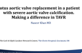 Lotus Aortic Valve Replacement in a Patient With Severe Aortic Valve Calcification: Making a Difference in TAVR