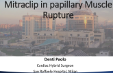Rescue MitraClip in Papillary Muscle Rupture
