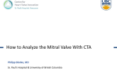 How to Analyze the Mitral Valve With CTA