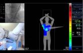 Color-Coded Radiation Monitoring: Coming to a Cath Lab Near You 
