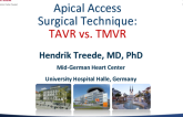 Apical Access Surgical Technique: TAVR vs TMVR