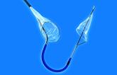 FDA Clears Sentinel Cerebral Protection Device for Use During TAVR