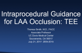 Intraprocedural Guidance for LAA Occlusion: TEE 