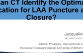 Can CT Identify the Optimal Location for LAA Puncture and Closure?