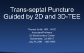 Trans-septal Puncture Guided by 2D and 3D-TEE 