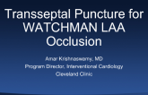 Transseptal Puncture forWATCHMAN LAA Occlusion