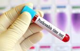 In Case of Emergency: Don’t Rely on ‘Normal’ Range Assays With DOACs