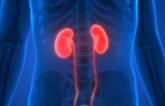 CKD Patients Undergoing PCI Much Less Likely to Receive Potent P2Y12 Inhibition