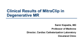 Clinical Results of MitraClip in Degenerative MR