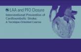 LAA and PFO Closure 2017