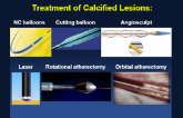 Calcium Management: Do We Underutilize Atherectomy?