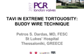 TAVI in Extreme Tortouosity: Buddy Wire Technique
