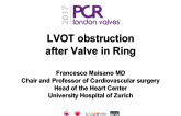 LVOT Obstruction After Valve in Ring