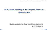 IVUS-Guided Rewiring in the Antegrade Approach: When and How?