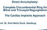 Cardiac Implants Direct Annuloplasty for Functional MR: Device, Procedure, and Outcomes
