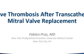Case Presentation: Valve Thrombosis After TMVR