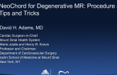 Neochord for Degenerative MR: Procedure and Tips and Tricks