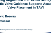 Using Augmented and Virtual Reality in Aortic Valve Guidance Supports Accurate Valve Placement in TAVI