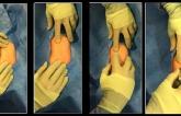 Top 10 Tricks for Transradial Procedures